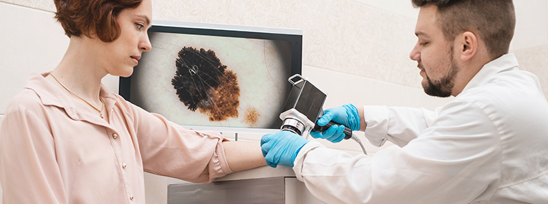 Виды новообразований кожи