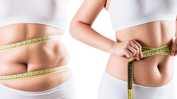 Вес под контролем: программа лечения ожирения на 90 дней