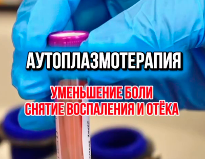 PRP-терапия - современный и безопасный метод лечения