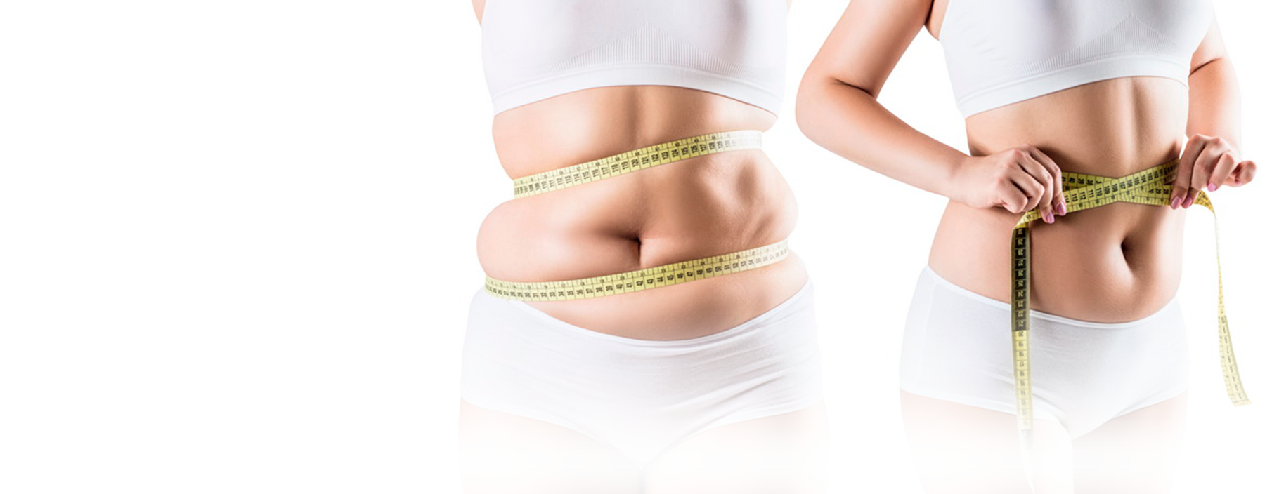 Программа лечения ожирения